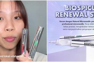 Diklaim bisa atasi bopeng, ini review Somethinc BioSpicule Renewal Serum yang viral di TikTok