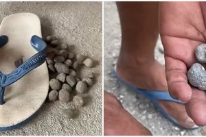 Nggak perlu beli, lifehack nyeleneh cara bikin sandal rematik ini gampang cuma modal batu jalanan