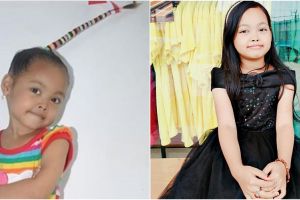 Lepas citra centil berganti jadi kalem, 11 transformasi Misca Mancung kini tampil cantik di usia ABG