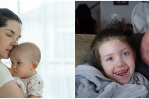 Bayi berusia 2 hari kena radang otak usai dicium, ini penjelasan medis dan cara mengantisipasinya