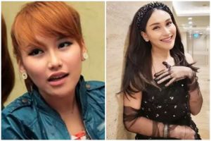 9 Potret Ayu Ting Ting sebelum & sesudah kenal treatment klinik kecantikan, makin mirip seleb Korea