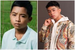 9 Potret Betrand Peto sebelum dan sesudah kenal treatment kecantikan ini beda pol, makin glow up