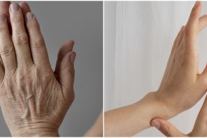 Tanpa dicampur lemon dan kuning telur, ini cara atasi kerutan pada tangan pakai 1 ampas buah