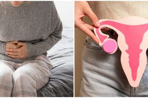 8 Makanan pemicu PCOS, hindari untuk kesehatan hormonal yang lebih baik