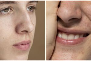 Efeknya bak pakai gua sha, ini cara kecilkan pori-pori dan redakan wajah bengkak pakai 1 bahan makanan