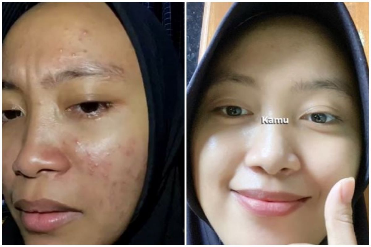 Face smooth & shiny, this girl shares the process of her
