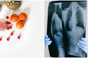 8 Jenis makanan ini bantu detoks paru-paru bagi pasien Penyakit Paru Obstruksi Kronik (PPOK)