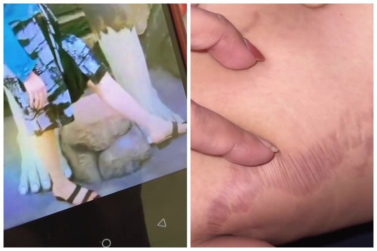 Bukannya jadi putih, kisah wanita pakai HB dosting dan krim abal-abal ini ngenes banget