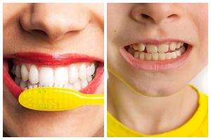 Tak lagi pakai pasta gigi whitening, dokter ini bagikan cara memutihkan gigi cuma pakai 1 jenis minyak