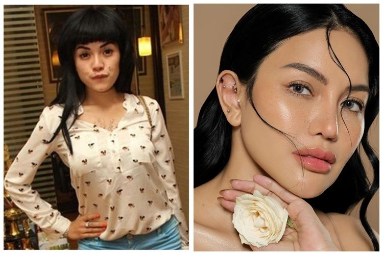 Habiskan duit Rp1 M untuk permak wajah, ini 9 potret sebelum & sesudah Nikita Mirzani perawatan wajah