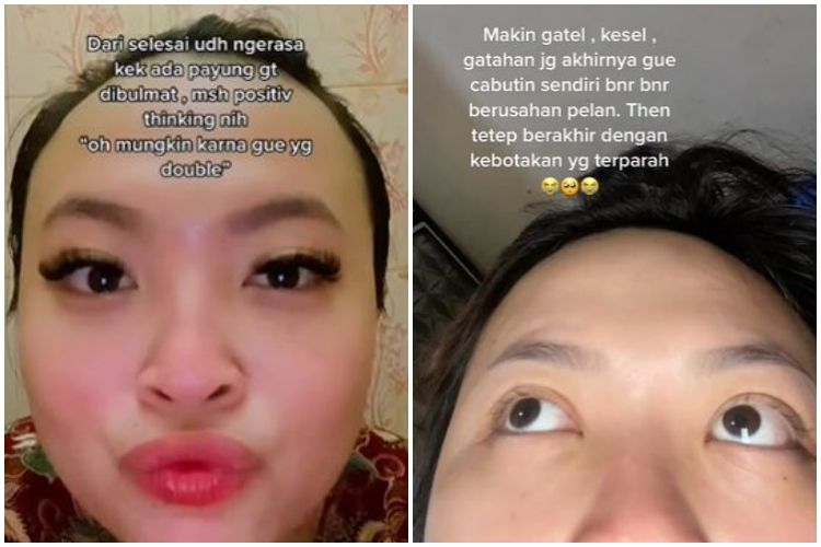 Bulu mata cewek ini jadi botak usai eyelash extension, kisahnya bikin nyesek pol