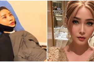 Sarwendah unggah potret terbaru usai jalani oplas di Korea, warganet sebut malah mirip Inul Daratista