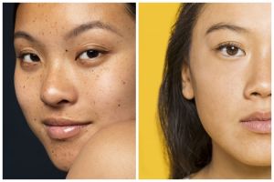 Cara menghilangkan flek hitam cuma pakai rosewater dicampur 1 jenis garam, bikin wajah auto glowing