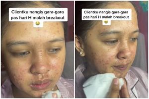 Wajah breakout di hari lamaran, cewek dirias MUA ala pinky makeup look ini foto before after manglingi