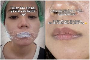 Niat hati ingin hemat lipstik, hasil sulam bibir cewek ini malah bikin miris bak disengat tawon