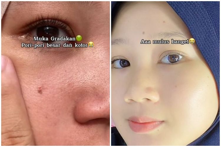 Kombinasi facial wash dan masker wajah ini bikin kulit gradakan auto mulus, begini cara memakainya