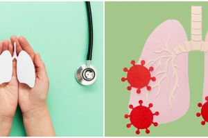 Jangan anggap sepele, kenali gejala, penyebab dan cara mengatasi paru-paru basah