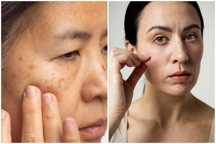 Cuma pakai daun herbal &amp;amp; susu bubuk bisa atasi flek hitam serta kerutan di wajah, ini cara mengolahnya