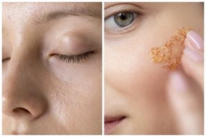 Jadi automulus, cewek ini bagikan cara atasi kulit gradakan cuma pakai ice cube dari 1 jenis tanaman