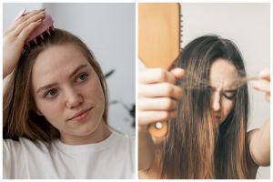 Cara atasi rambut rontok berlebih ini cuma pakai 2 bahan alami, hasilnya bikin tumbuh lebat kembali