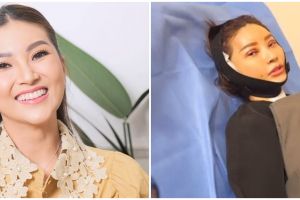 Dicibir usai jalani operasi plastik, Sarwendah sebut tak ambil pusing asal nggak merugikan orang lain