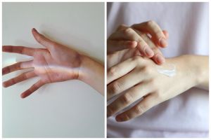 Cara atasi kulit belang dalam 7 hari cuma pakai 3 bahan ini bikin cerah kembali