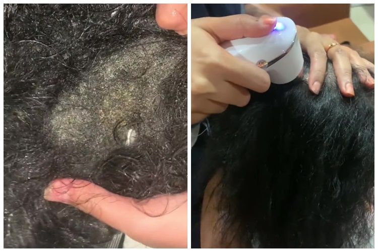 Hair extension cewek ini rusak parah usai main ke pantai, penampilan rambutnya bikin ngilu