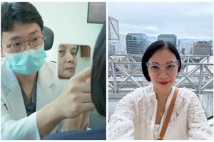 6 Before-after seleb usia 50-an lakukan facelift, Dian Nitami putuskan operasi usai 13 tahun menunda