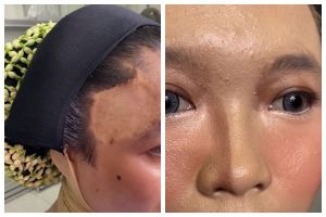 Kulit belang karena bekas operasi, MUA ini sulap wajah pengantin Jawa jadi mulus dan anticrack