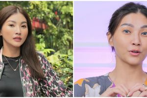 Ungkap alasan jalani oplas di Korea Selatan demi pekerjaan, Sarwendah bantah dapat endorse