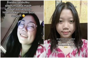Punya rambut rapuh nekat pakai produk pelurus, kisah wanita ini berakhir nyesek