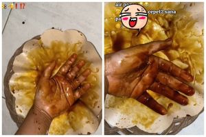 Cara warganet atasi tangan tersiram air panas ini aneh banget, tapi idenya ampuh cegah kulit melepuh