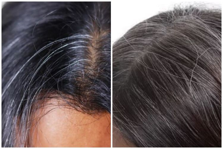 Deodoran DIY Tanpa Bahan Kimia: Pilihan Sehat Untuk Anda Deodoran DIY Tanpa Bahan Kimia: Pilihan Sehat Untuk Anda