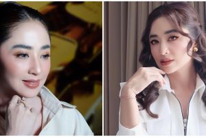 Dewi Perssik ngaku pernah tolak tawaran endorse operasi hidung Rp1 miliar, alasannya takut karena ini
