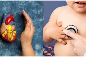 Kenali penyebab, gejala, dan cara mengatasi penyakit jantung bawaan pada bayi