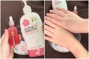 Kombinasi lotion Alpha Arbutin & body serum pemutih ini efektif atasi kulit kusam, ini cara meraciknya