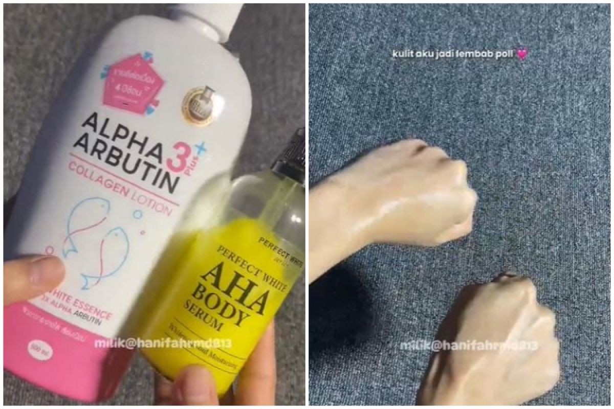 This mixture of Alpha Arbutin body lotion and AHA body serum makes skin