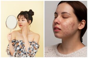 7 Rekomendasi skincare Skintific untuk kulit berjerawat harga mulai Rp100 ribuan