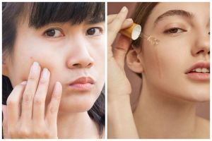 11 Rekomendasi skincare untuk kulit sensitif merek lokal harga di bawah Rp 150 ribu