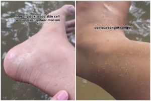Nggak perlu skincare mahal, cara cewek hilangkan daki di kulit dalam hitungan menit ini modal Rp 0