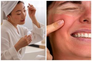 Bahaya skincare merkuri bagi kesehatan tubuh, bisa sebabkan penyakit ginjal serius
