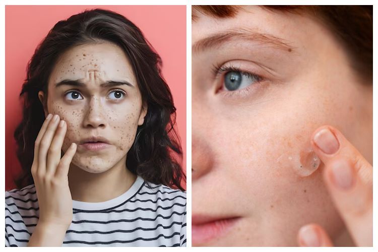 Mencuba Skincare Bebas Fragrance – Kulit Jadi Lebih Tenang?