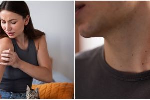 7 Bahaya penyakit kebiasaan bertukar pakaian, bisa tularkan infeksi jamur menular