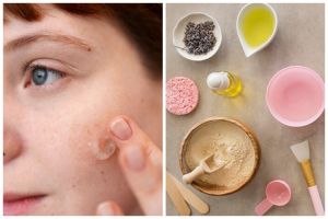 [KUIS] Cari tahu kandungan skincare yang paling cocok buat wajah kusam dari kondisi kulitmu sekarang