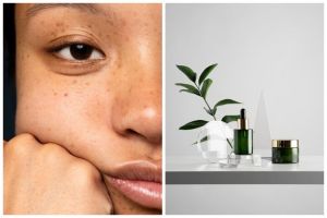 [KUIS] Melasyl atau retinol? Cari tahu kandungan skincare buat flek hitam yang paling ampuh