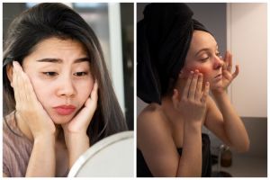 Ketahui 7 penyebab dan ciri-ciri skin barrier rusak, beserta cara mengatasinya