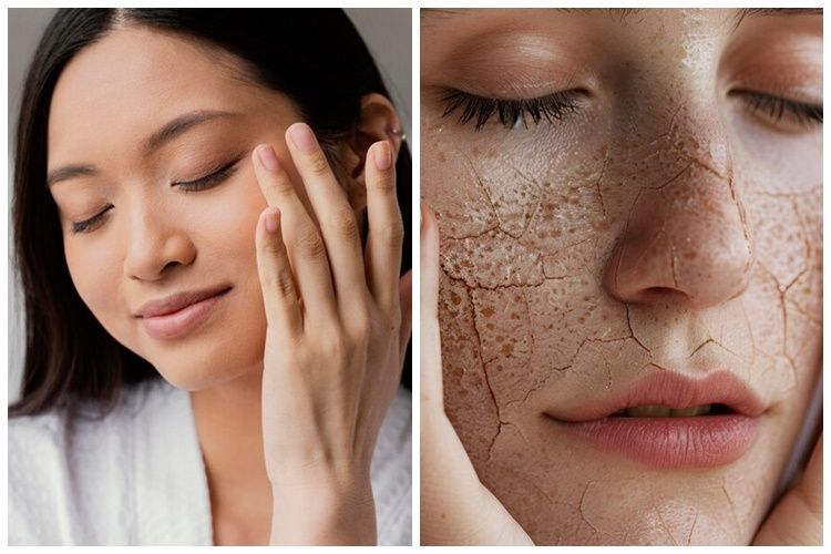 9 Produk skincare Azarine untuk atasi kulit kering harga di bawah Rp 150 ribu, wajah cerah terhidrasi