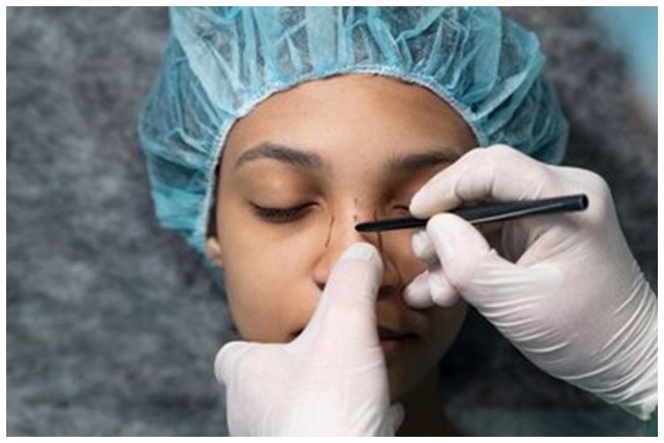 [KUIS] Tren operasi hidung di kalangan seleb, nilai berapa level urgensi kamu buat operasi hidung