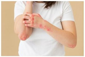 [KUIS] Amankah sharing makeup dengan orang lain? Kenali bahayanya lewat pertanyaan ini yuk!