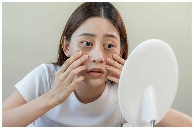 [KUIS] Bukan cuma dikompres, ini cara efektif mengatasi kantung mata berdasarkan gejalanya